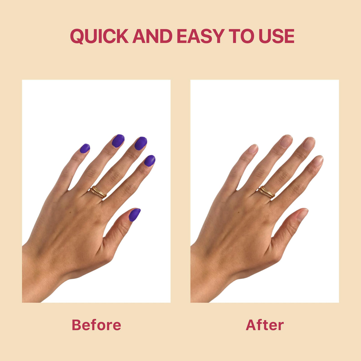 100% Pure Acetone Nail Polish Remover | Professional Quality | Easy To Use | Rapidly Removes Natural, Gel, Acrylic, shellac, and Glitter Nails | 8 Fl oz